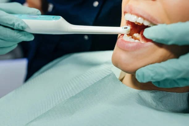 Dental Fillings